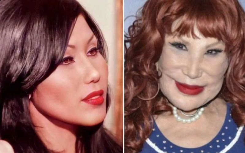 A Trágica Transformação de Lyn May: A Estrela Mexicana Que Viralizou com Sua Desfiguração Facial