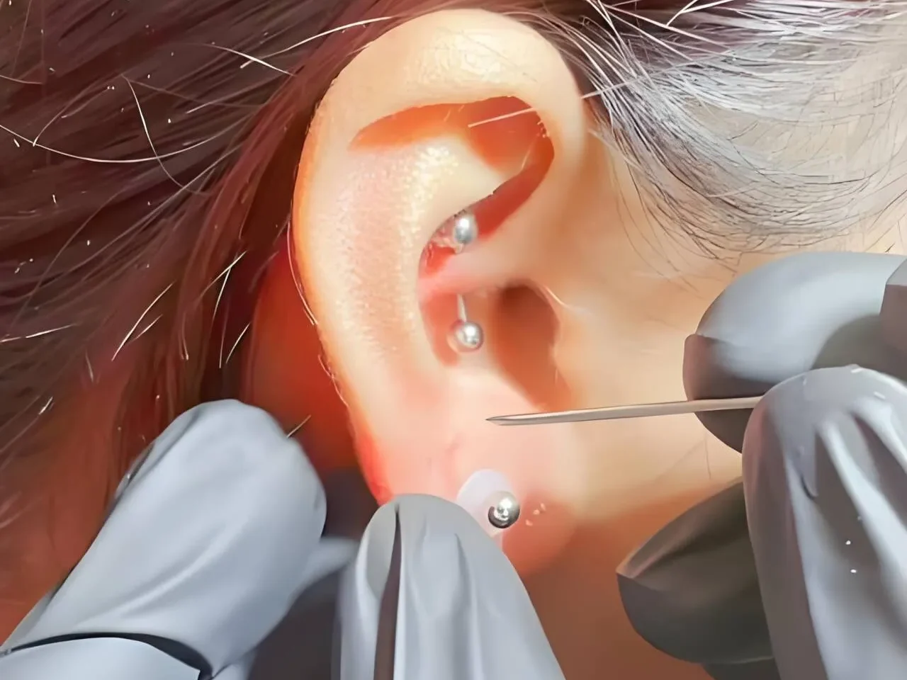 Piercing na Orelha:Agulha Cirúrgica por Perfurador Profissional