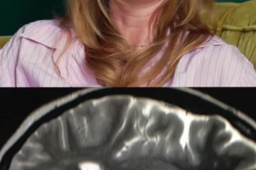 Neurocisticercose: viagem à Índia deixou 38 cistos no cérebro de jornalista