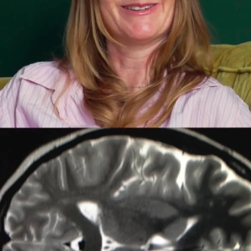 Neurocisticercose: viagem à Índia deixou 38 cistos no cérebro de jornalista