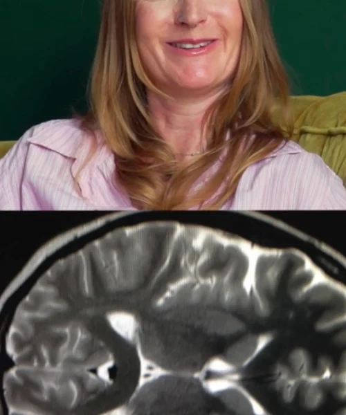 Neurocisticercose: viagem à Índia deixou 38 cistos no cérebro de jornalista