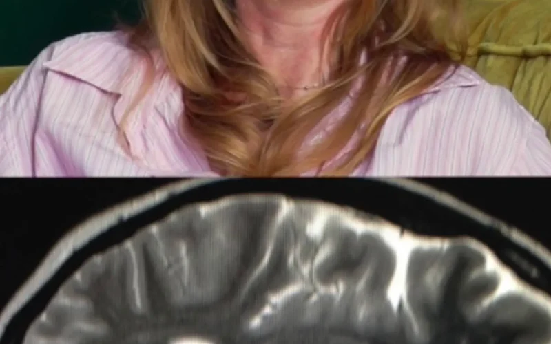 Neurocisticercose: viagem à Índia deixou 38 cistos no cérebro de jornalista
